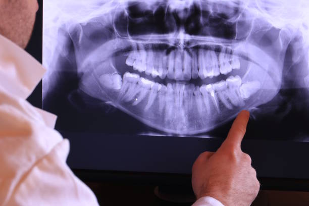 Best Emergency Dental Care for Broken or Chipped Teeth in Point Pleasant Beach, NJ
