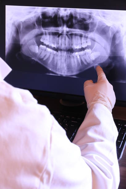 Best Emergency Treatment for Dental Infections or Abscesses in Point Pleasant Beach, NJ